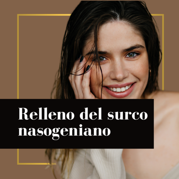 Relleno del surco nasogeniano con ácido hialurónico